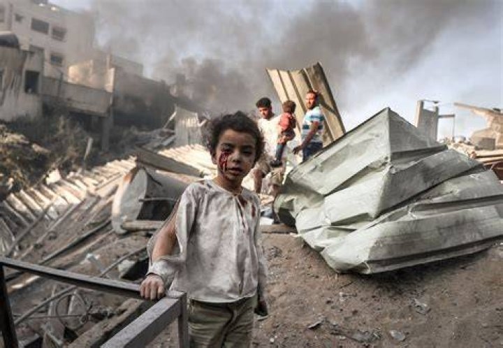 Child Struck by Bombs