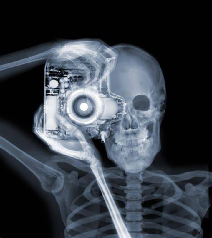 Cool X Ray Art