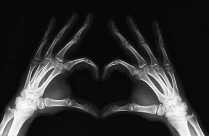 Cool Xray Photos