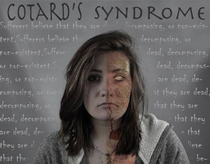 Cotard Delusion Disorder