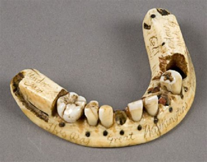 Dentures In The 18th Century