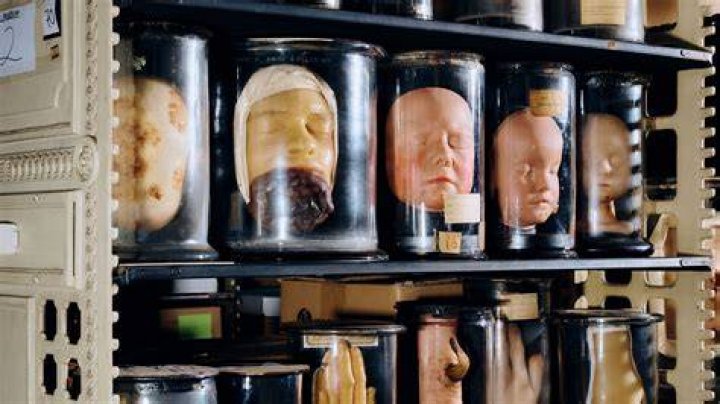 Dried Hands From Mutter Museum