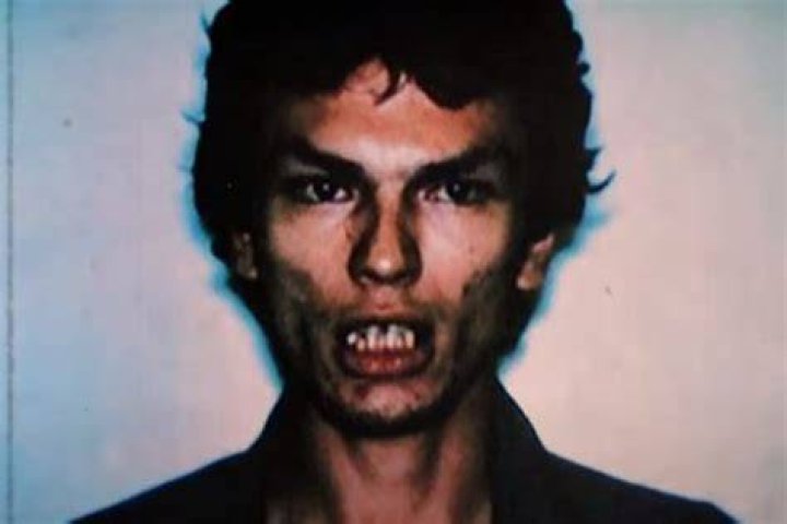 Richard Ramirez Teeth Fixed