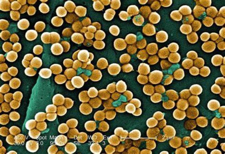 Scary Diseases MRSA