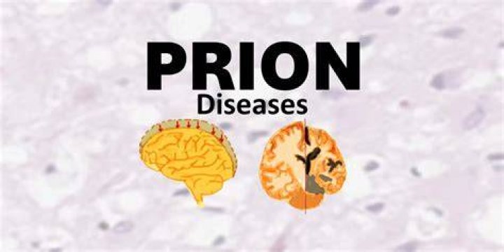 Scary Diseases Prion Brain