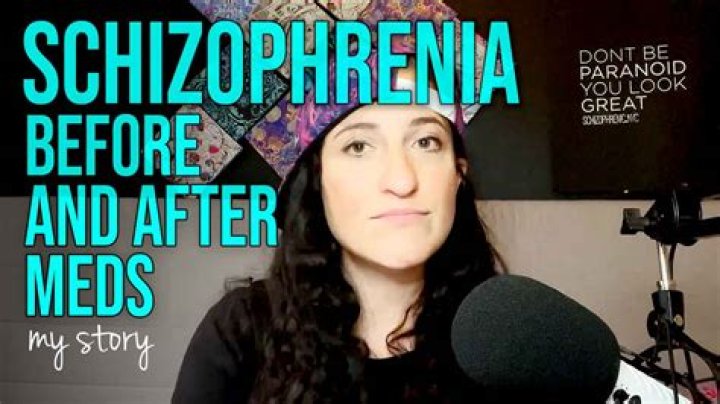 Schizophrenia Patient Before And After A Lobotomy