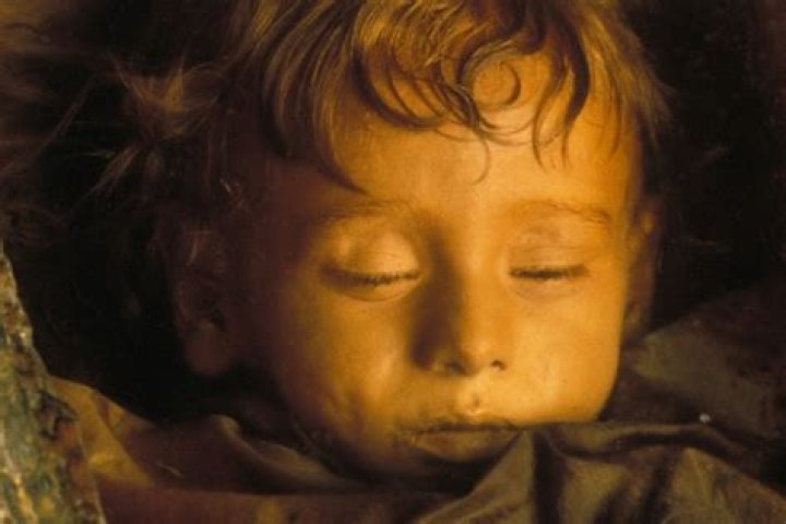 The Mummy Of Rosalia Lombardo