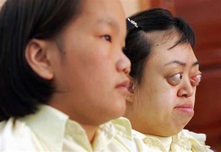 Victims Of Agent Orange