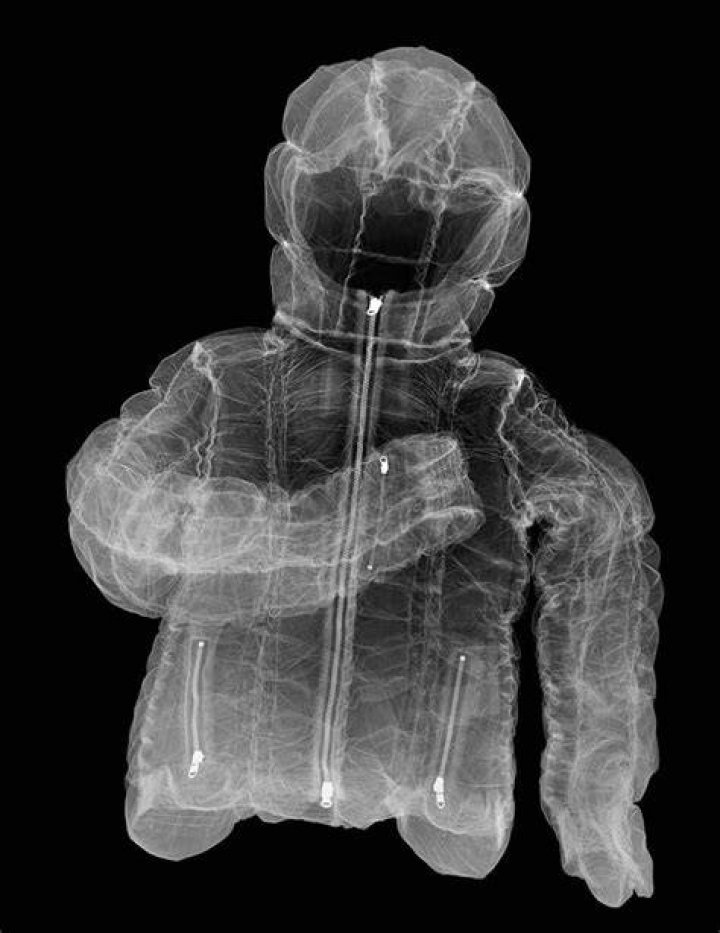X-ray Art Jacket