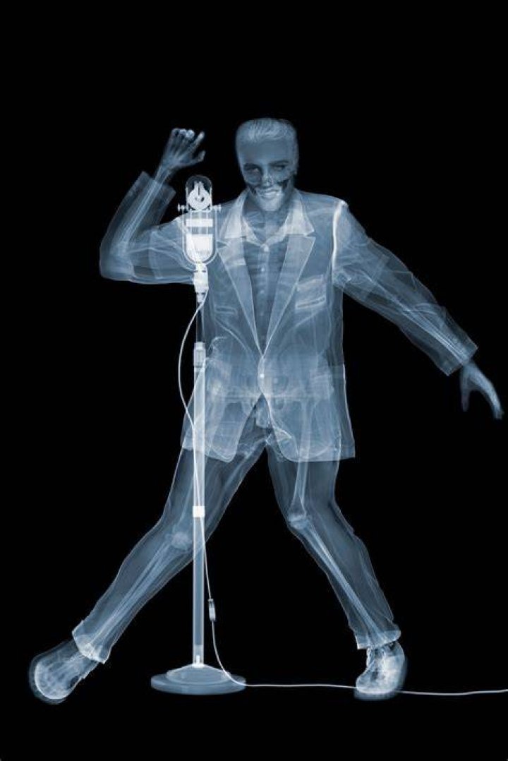 X-Ray Art
